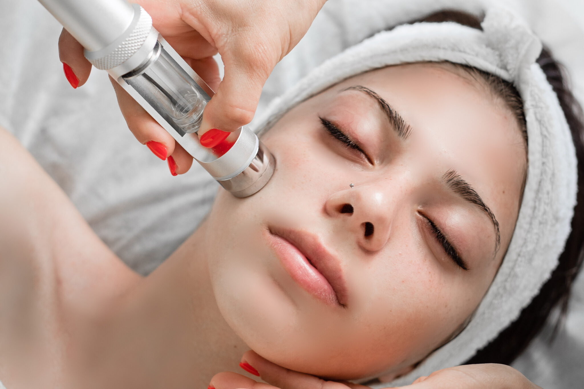 Microneedling - benefits of the cosmetic procedure